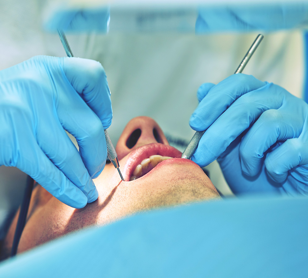 imagen de profesional de Clínica Dental Valeria Bolbarán practicando Periodoncia y crugía oral. 