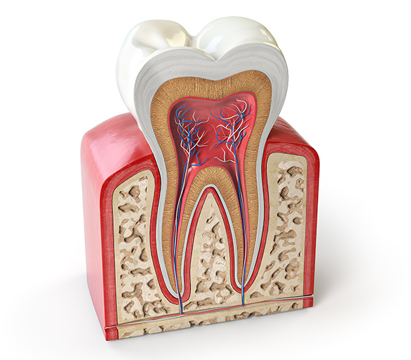 ilustración del interior del diente para observar la técnica de matar el nercio en Clínica Dental Valeria Bolbarán. 